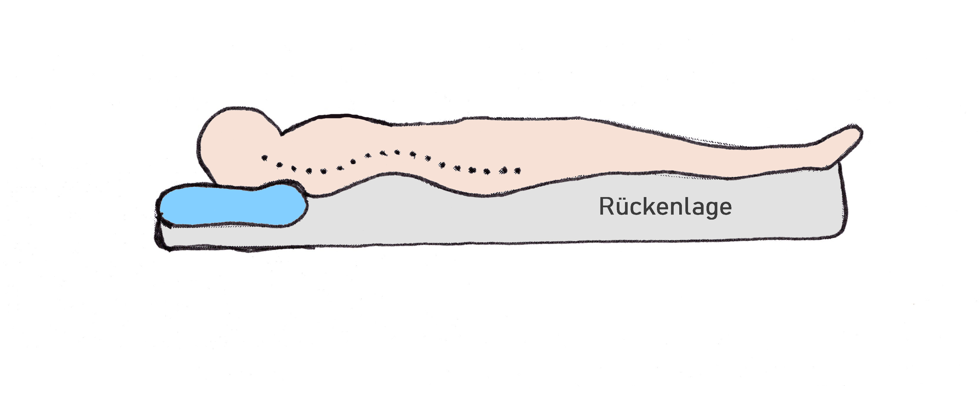 supine pos 1