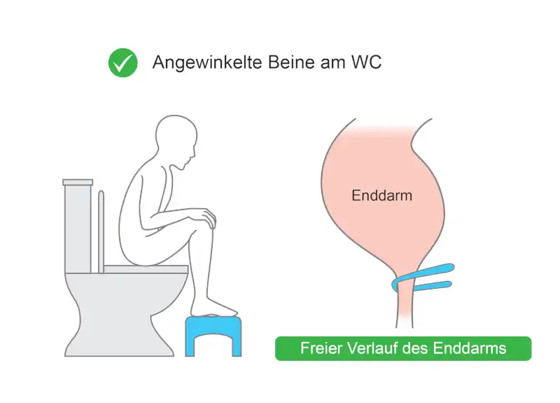 Wie man schonen Stuhl absetzt